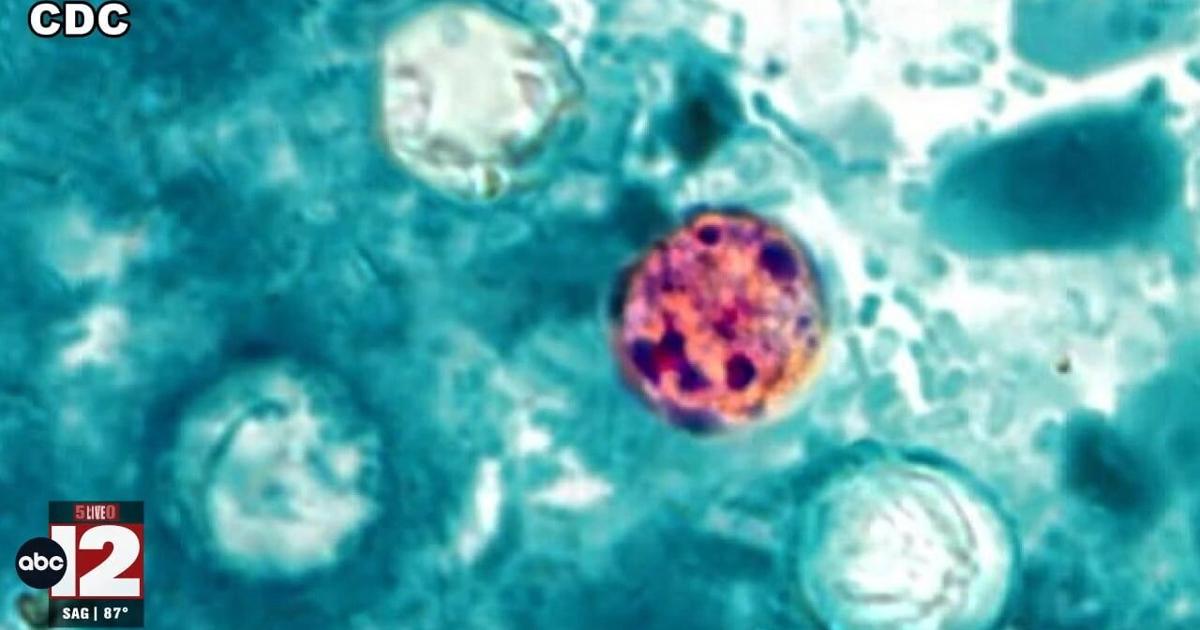 Michigan cyclosporiasis cases near 1,000; state launches webpage | Health