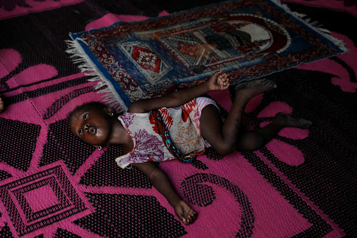 Nigerian children pay the price for the Iran war as malnutrition and poverty surge
