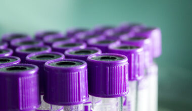 U.S. military testosterone screening is an unprecedented experiment