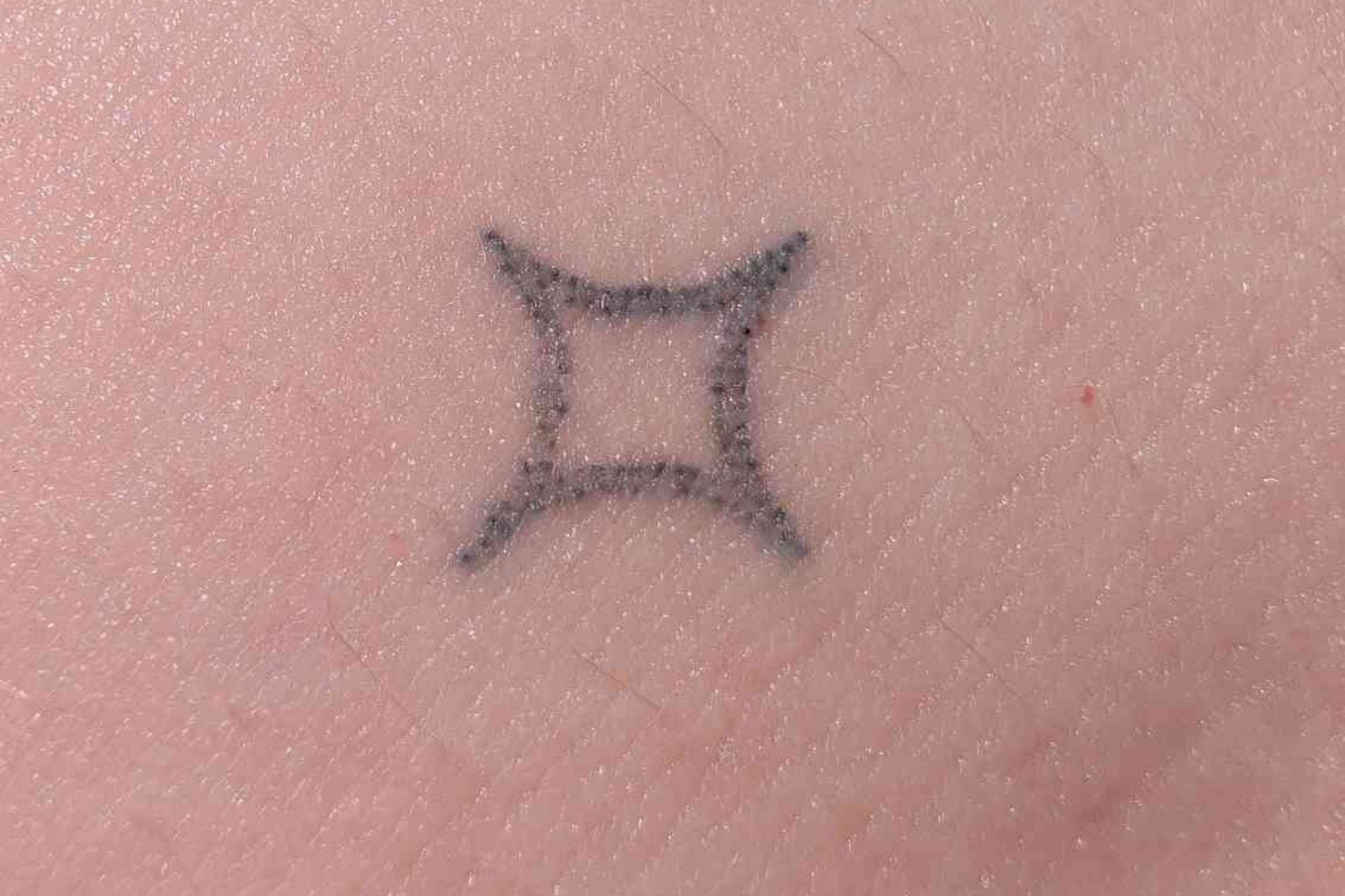 A close up photograph of a healed Microdot tattoo, showing visible dots.