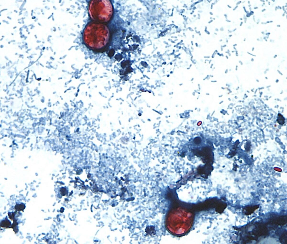 Cyclospora parasite in PA, NJ: Here’s what to know