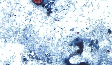 Cyclospora parasite in PA, NJ: Here’s what to know