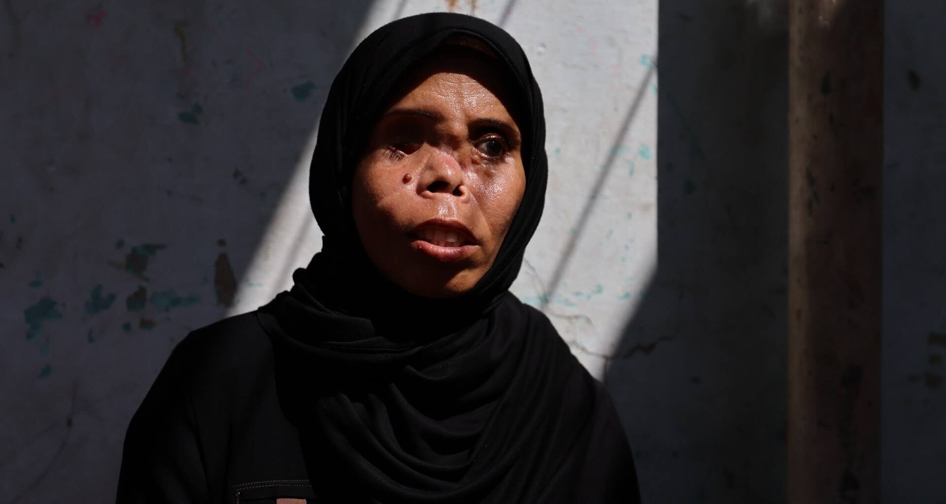 In Gaza, a long path to recovery for one woman who lost eye, and daughter | Israel-Palestine conflict News