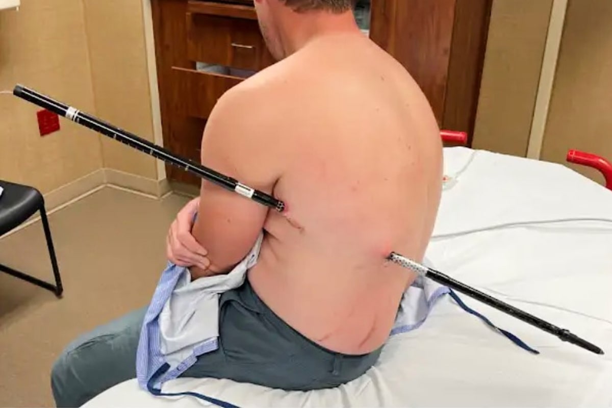 Montana hiker treks to safety after impaling himself on trekking pole