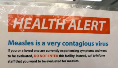 Measles exposure in Scarborough