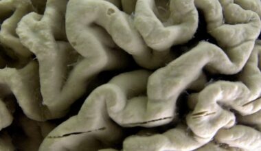 Health news: Blood test may predict Alzheimer’s Disease