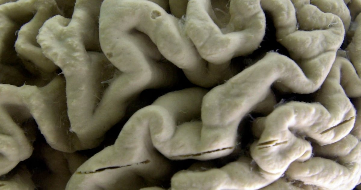 Health news: Blood test may predict Alzheimer’s Disease