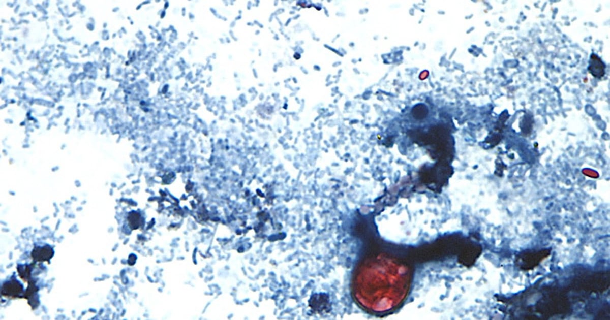 Diarrhea-causing parasite infecting more than 1,200 in Michigan has not spread to Canada: PHAC - CTV News