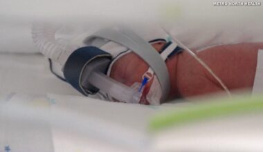 Australian woman gives birth to rare identical quadruplet daughters