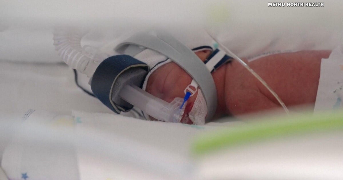 Australian woman gives birth to rare identical quadruplet daughters