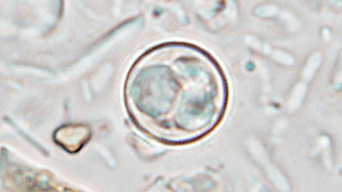 Oocyst of C. cayetanensis.