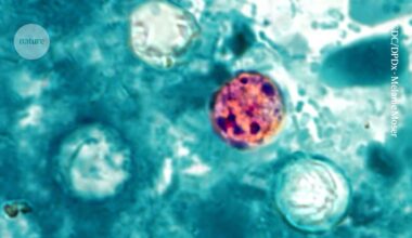 ‘Explosive diarrhoea’ outbreak grips US: how researchers are hunting its source