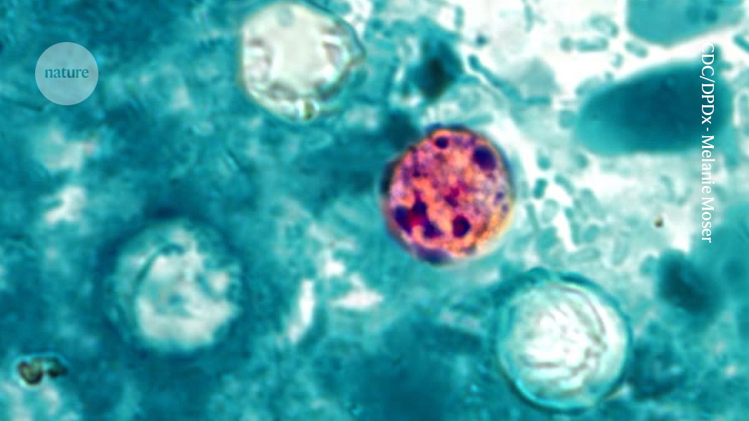 ‘Explosive diarrhoea’ outbreak grips US: how researchers are hunting its source