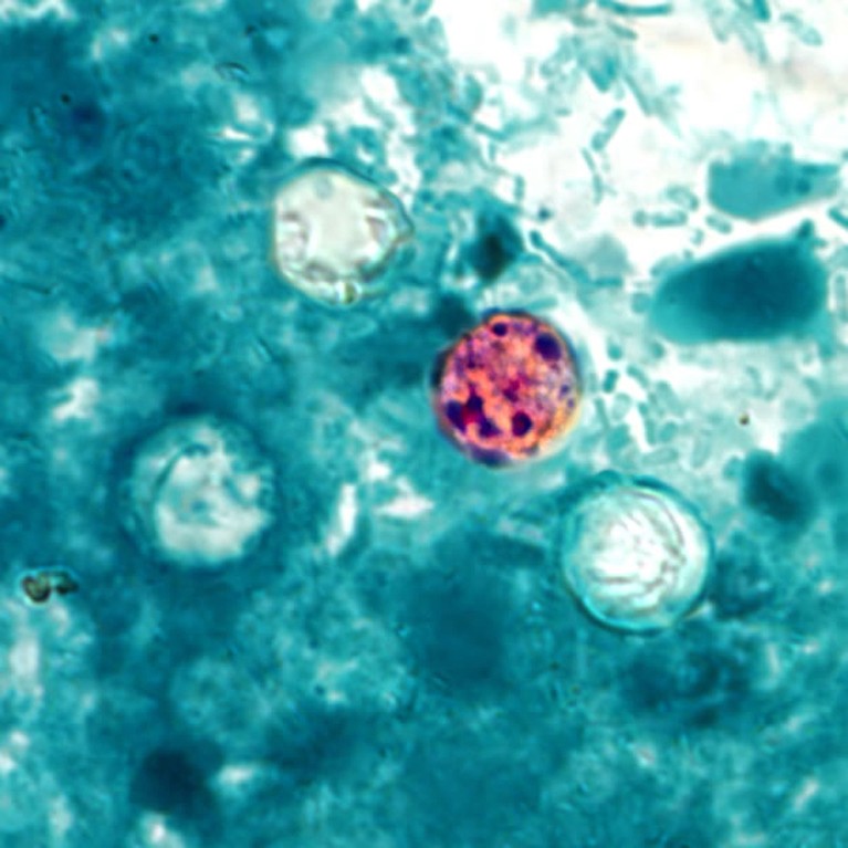 A photomicrograph showing a round, pink-orange stained Cyclospora cayetanensis oocyst with several dark purple spots at its centre, surrounded by three other pale green Cyclospora cayetanensis oocysts against a blue-green background