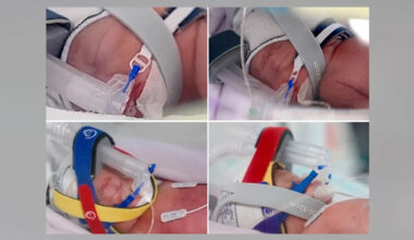 Woman becomes mom of 8 with birth of rare identical quadruplet daughters