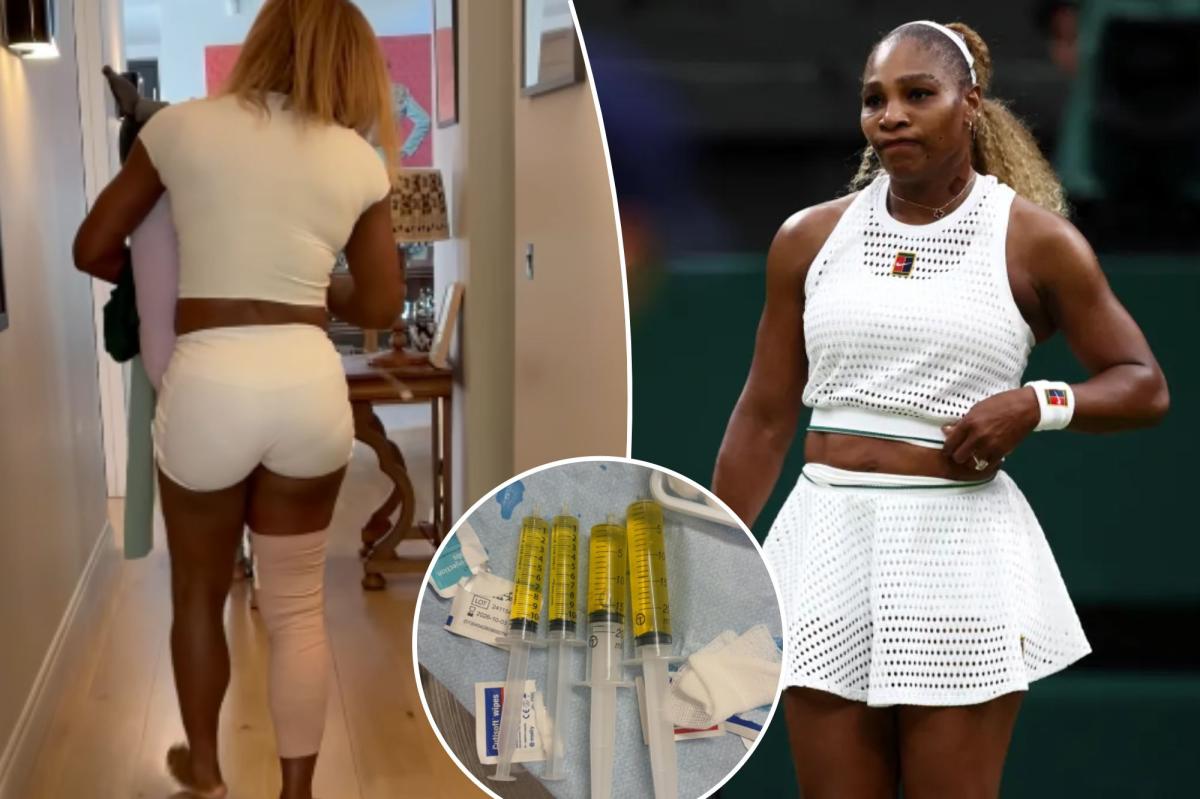 Serena Williams withdraws from Wimbledon doubles match with sister Venus because of injury