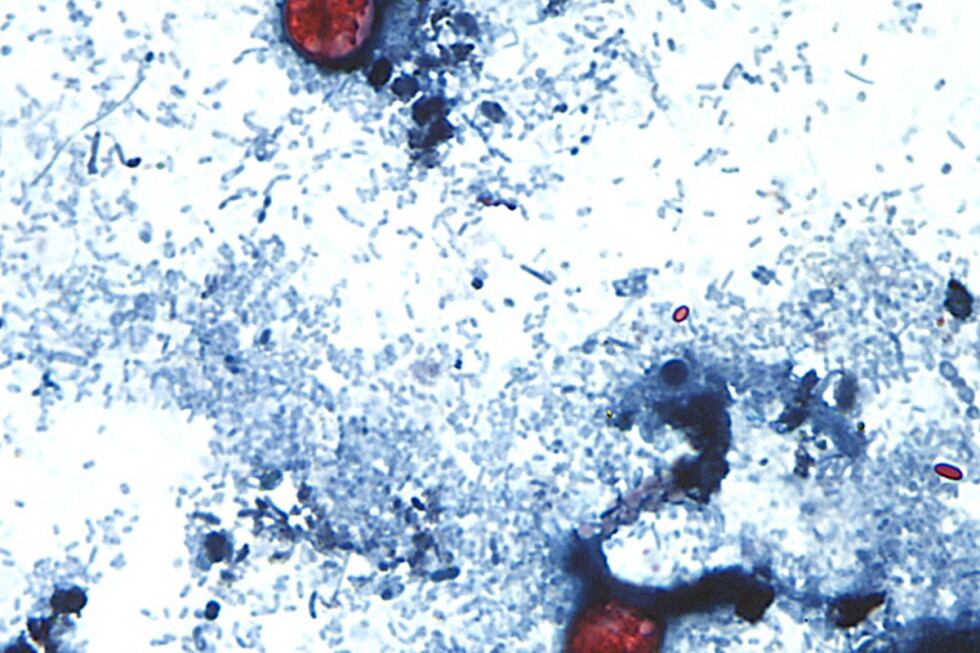 Cyclospora outbreak cases top 1,000 in Michigan and Ohio