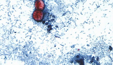 US health officials are investigating a new cyclospora outbreak