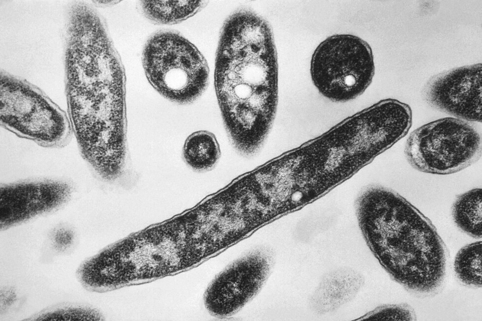 Legionnaires’ disease outbreak in New York City kills two, sickens dozens
