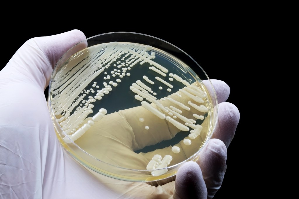 A gloved hand holding a petri dish with a Candida auris culture