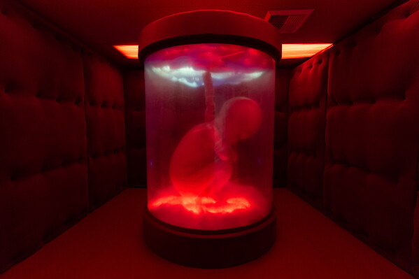 A fetal figure is displayed in an installation by artist Jonathan Elkies in the Resilience Department during the "Hospital of Emotions" exhibition inside a former hospital building in Los Angeles, Wednesday, July 22, 2026. (AP Photo/Jae C. Hong)
