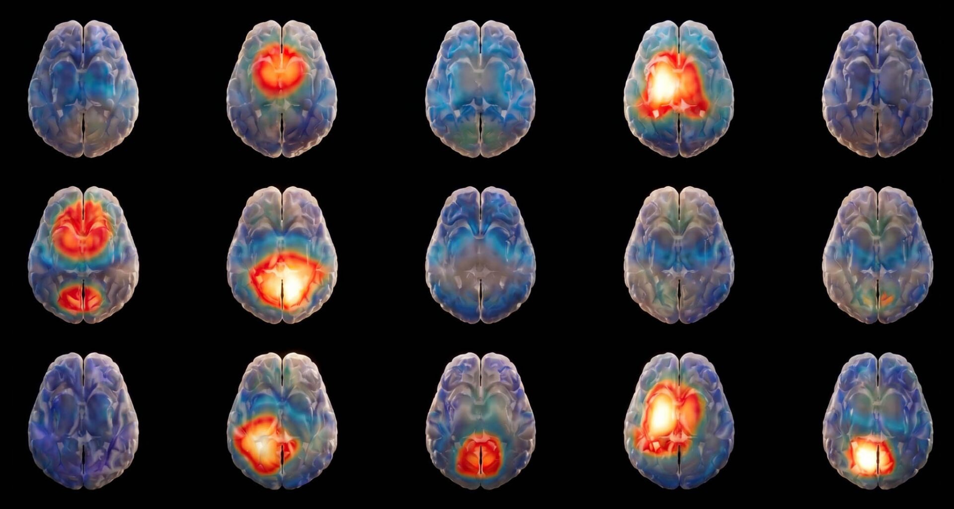 Israeli startup looks to harness AI to decode the 'language' of the brain