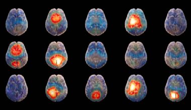 Israeli startup looks to harness AI to decode the 'language' of the brain