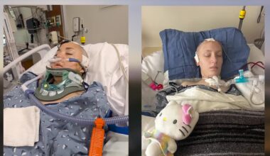 Six Flags X2 roller coaster linked to reported brain injuries
