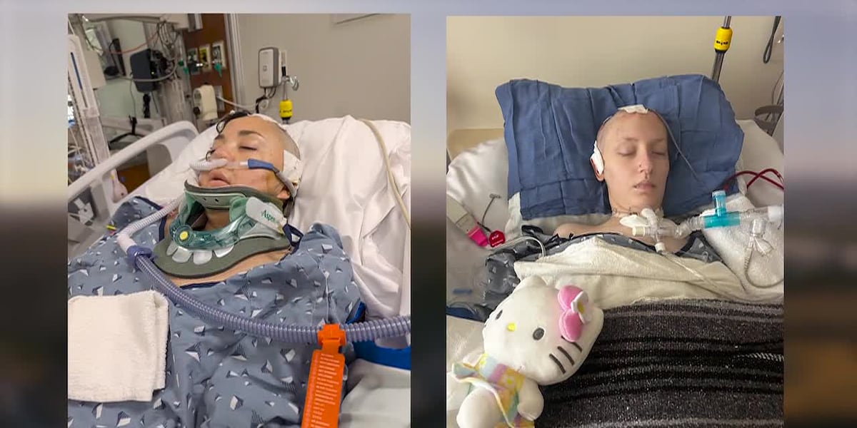Six Flags X2 roller coaster linked to reported brain injuries