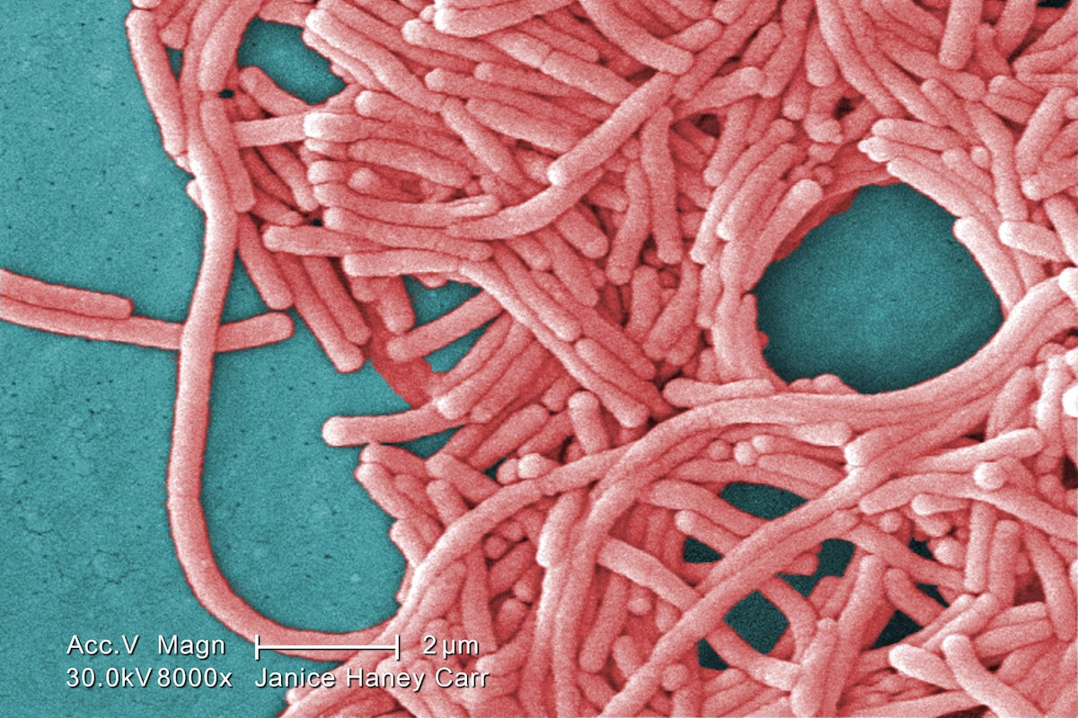 Outbreak of legionnaires’ disease being investigated near downtown core in Toronto