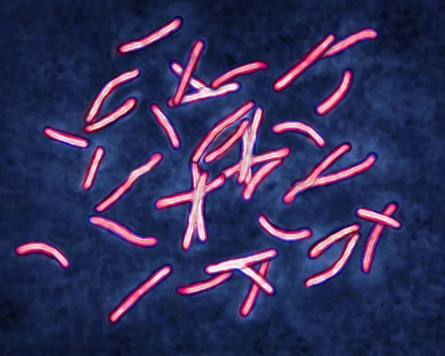 Bacillus Koch (Bk) or Mycobacterium tuberculosis, it is responsible for tuberculosis. Tuberculosis is making a comeback due to the appearance of multi-resistant bacterial strains. Pulmonary tuberculosis (phthisis) is the most widespread, but there are bone disorders (Pott's disease, white tumor of the knee), renal, intestinal, genital, meningeal and skin disorders (tuberculomas). Image taken from an X 1000 optical microscopy. (Photo by: CAVALLINI JAMES/BSIP/Universal Images Group via Getty Images)