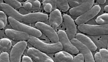 5 people have died from Vibrio vulnificus in Louisiana this year