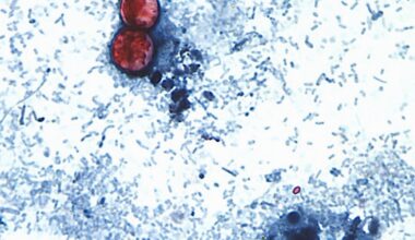 Cyclospora outbreak linked to recalled iceberg lettuce tied to 3 more states, FDA says