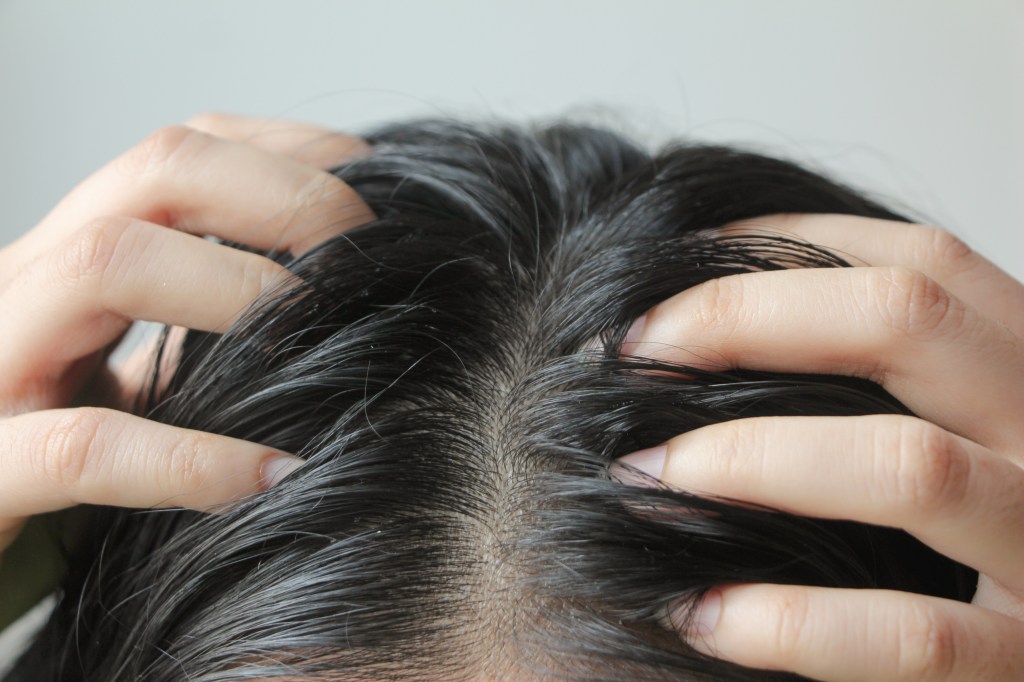 A close-up of a person's head with long black hair, scratching their scalp, revealing dandruff