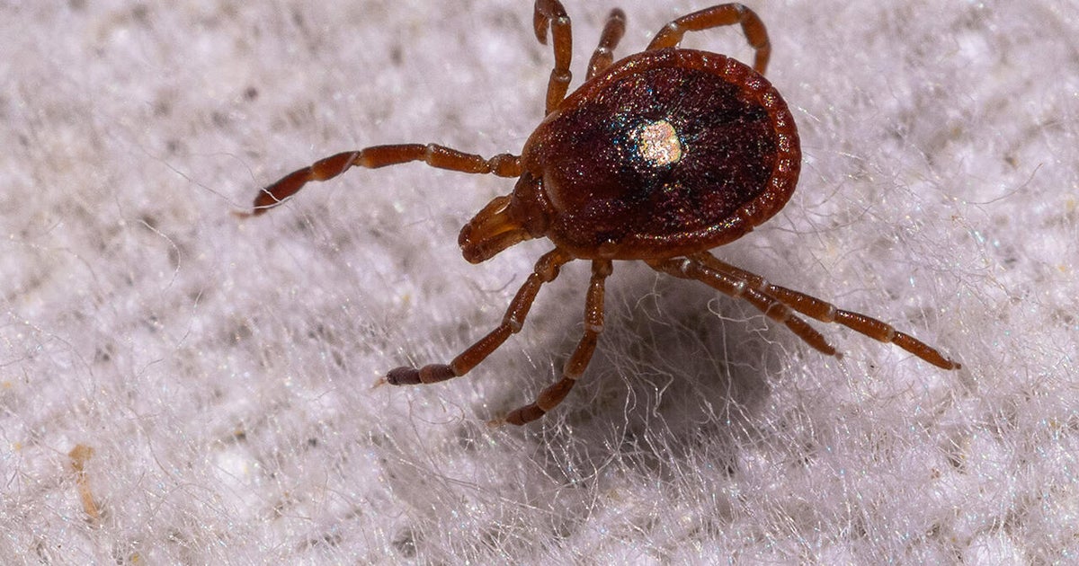 No red meat, no dairy, and no end in sight: How a tick-borne allergy has transformed Martha's Vineyard