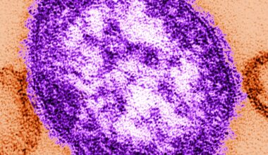 Measles in PA: 2 unvaccinated people die as outbreak grows