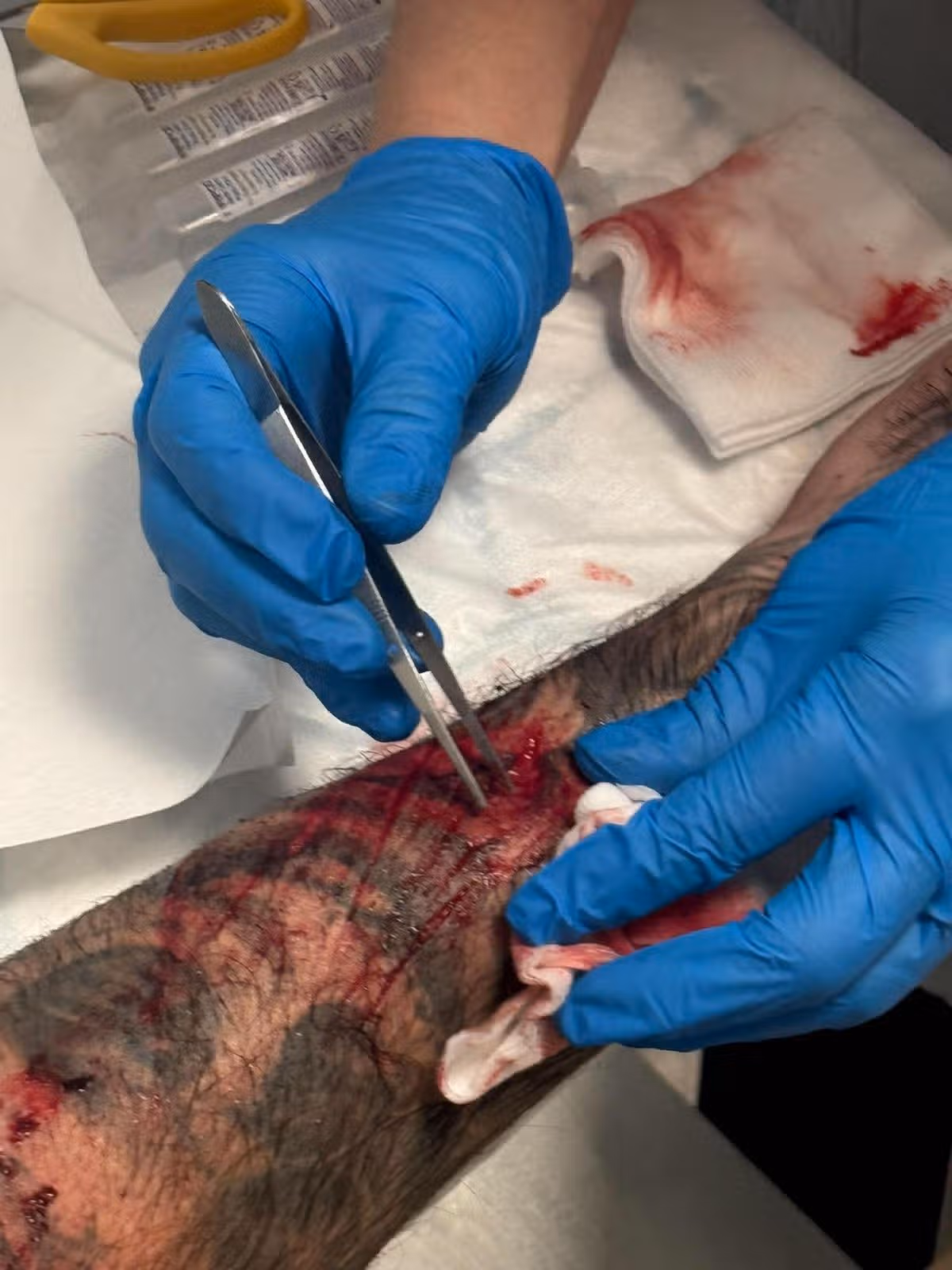 Gary had to get nine stitches in his forearm