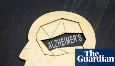 Alzheimer’s trial to test drug on people without symptoms to see if it can be prevented | Alzheimer's