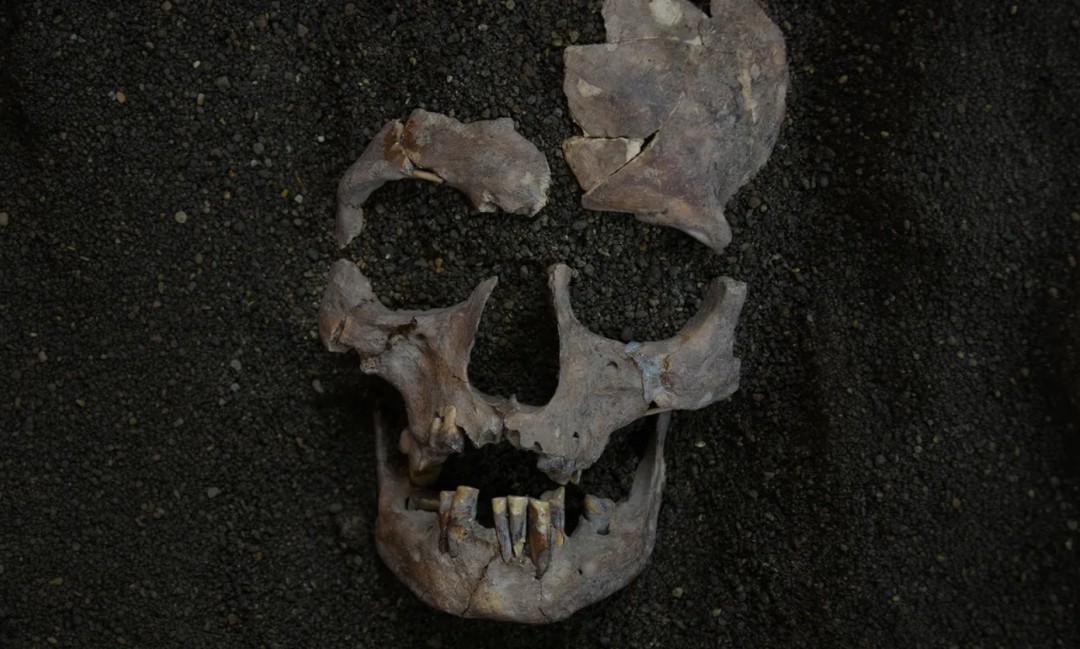 It's Oldest Evidence of Habitual Drug Use—and the Damage