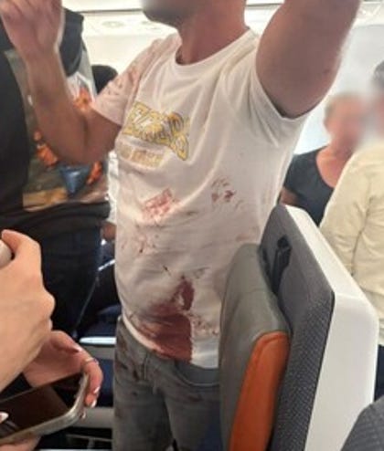A passenger is seen covered in blood in this image shared on social media. Credit: Use under Section 27A of the Copyright Law A passenger is seen covered in blood in this image shared on social media.