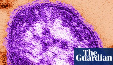 Six-week-old child in Pennsylvania dies from measles, coroner says | Pennsylvania
