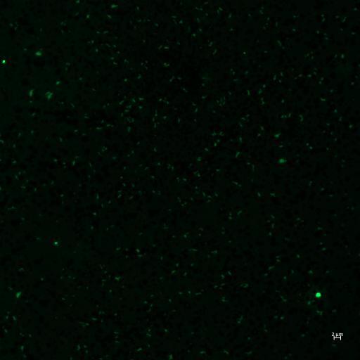 Picophytoplankton (Photo: Tali Kobas) האצה שגרמה להשבתה