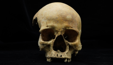 a front-facing human skull minus the mandible against a black background, revealing a curiously wide nasal opening