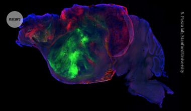 Human brain cells transplanted into mice in ‘most extensive’ integration ever