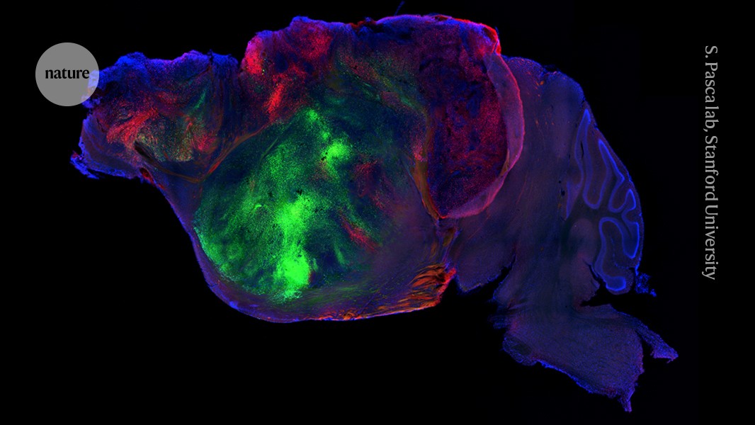 Human brain cells transplanted into mice in ‘most extensive’ integration ever