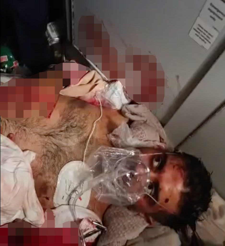 A pilot with facial injuries, wearing an oxygen mask, is assisted by passengers while the co-pilot lies unconscious on a Flydubai flight.