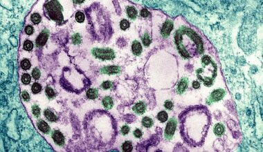 A Scientist Bled to Death for Two Weeks. The Virus He Left Behind Is Sitting in His Lab.