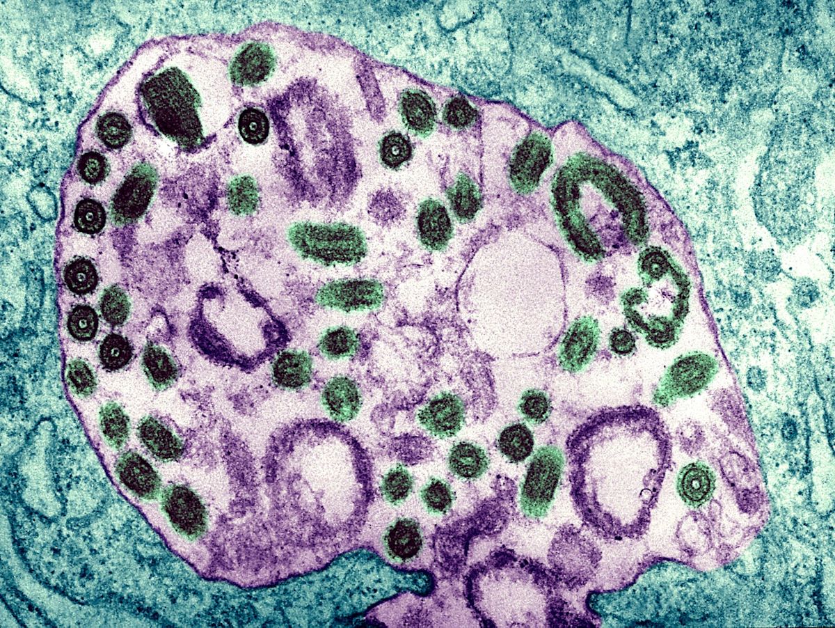 A Scientist Bled to Death for Two Weeks. The Virus He Left Behind Is Sitting in His Lab.
