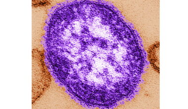 Pennsylvanian dies from measles-related complications amid state rift with feds : NPR