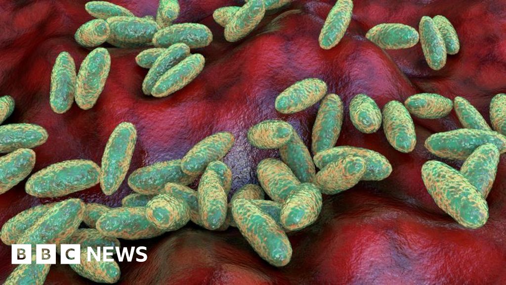 What is pneumonic plague and how does it spread? - BBC